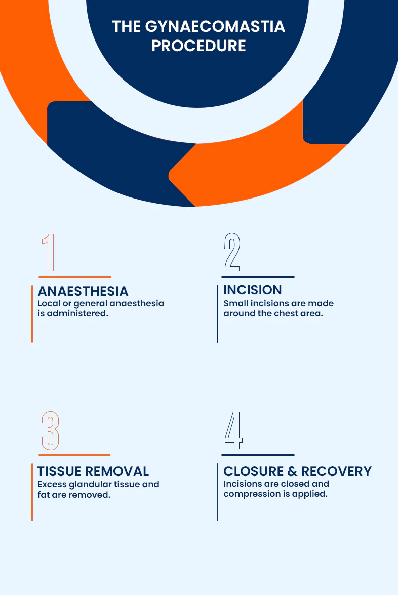 Gynecomastia surgery procedure overview