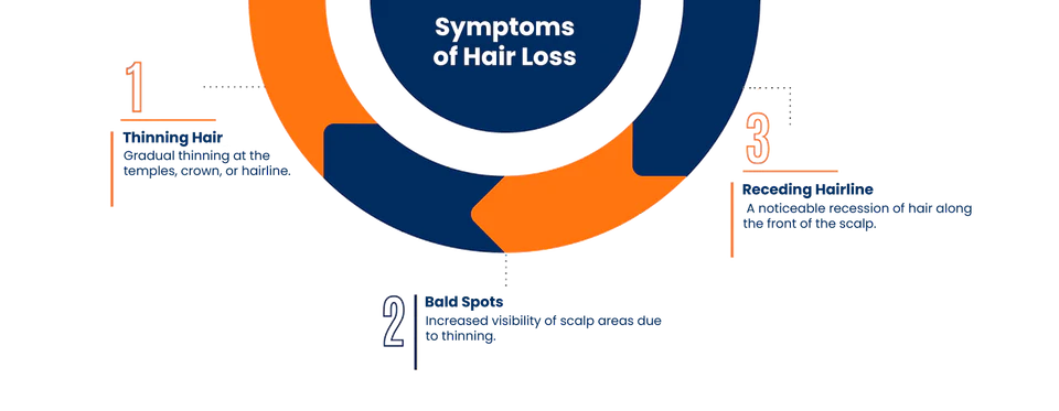 Illustration showing common patterns of hair loss