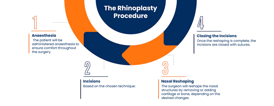 Rhinoplasty procedure illustration