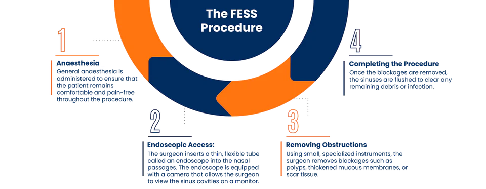 Functional endoscopic sinus surgery procedure illustration