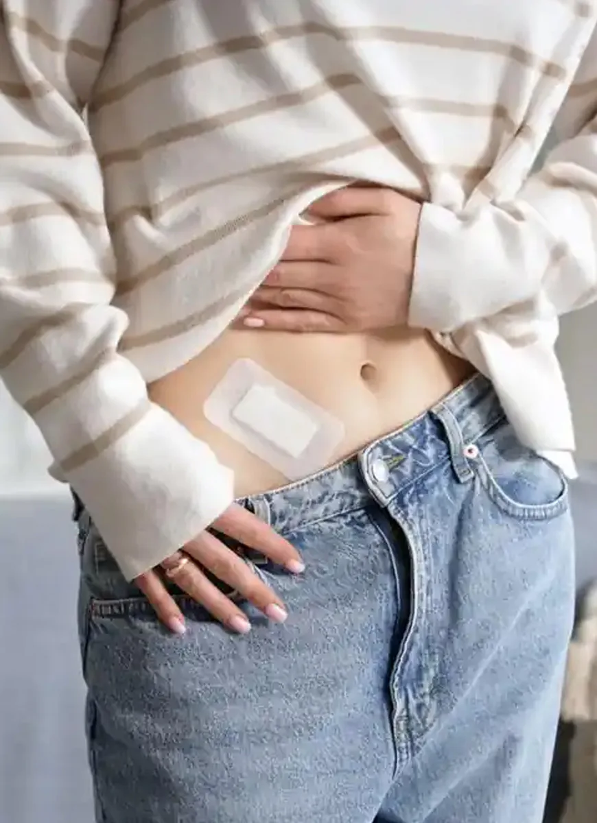 Abdominal dressing after appendix removal surgery