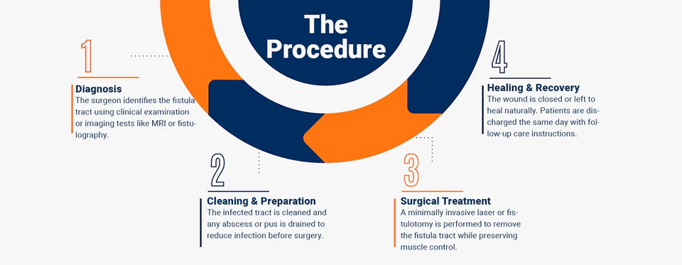 Anal fistula treatment process