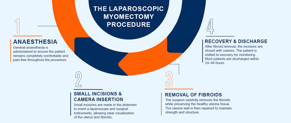 Laparoscopic myomectomy procedure overview