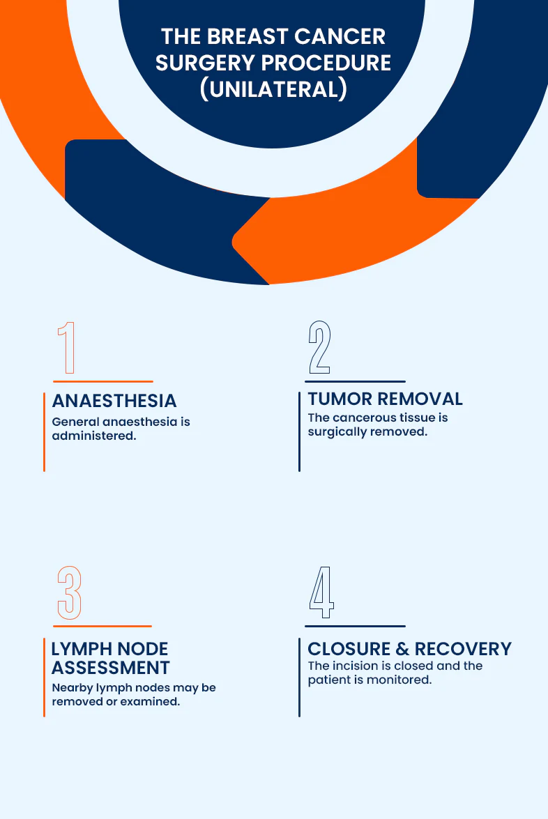 Unilateral breast cancer surgery procedure overview