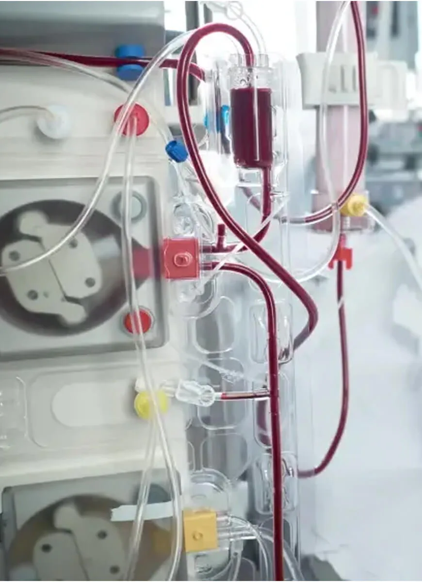 Care and monitoring after a dialysis session