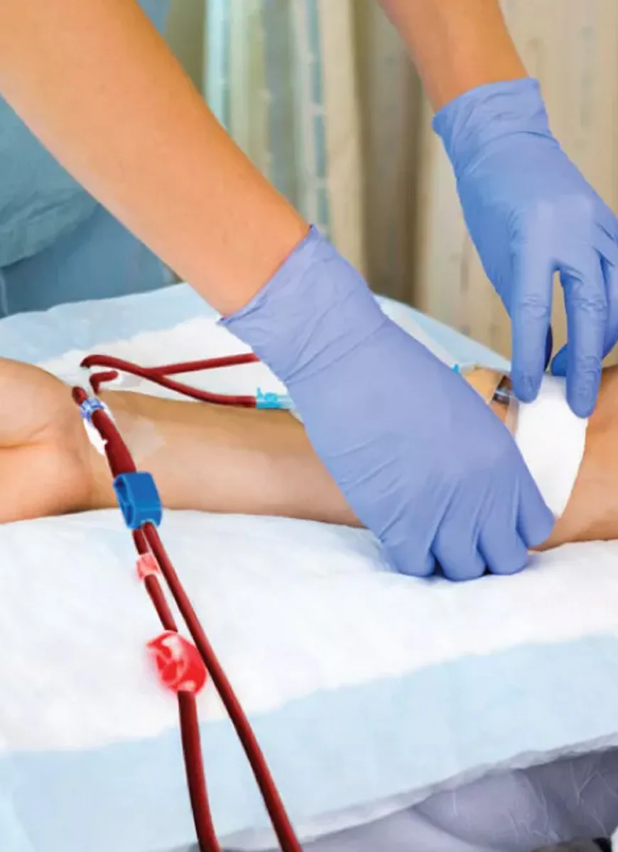 Recovery and aftercare following AV fistula surgery