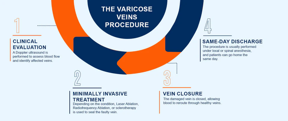Varicose vein treatment procedure overview
