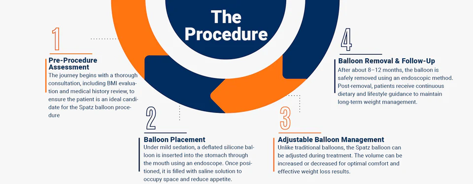 Spatz intragastric balloon treatment process